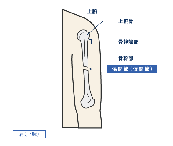 肩（上腕）